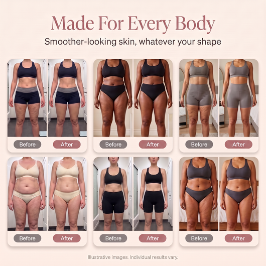 CloudRoll™ 2.0 - For Cellulite That Survived Everything You Tried